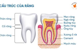 Răng sâu bị vỡ chỉ còn chân răng sẽ phải xử lý ra sao?