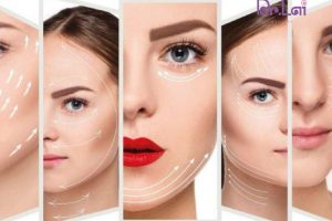 Những công dụng của HIFU khiến nhiều người lựa chọn trẻ hóa da