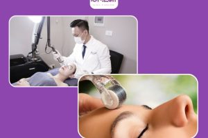 Cách chữa mụn ẩn ở trên trán hiệu quả tại nhà: Giải pháp an toàn cho làn da mịn màng